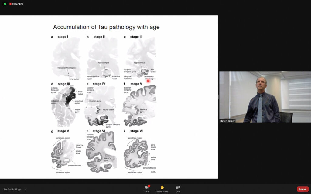 Barger addresses how over age, different parts of the brain are affected that cause Alzheimer's disease. (THE SIGNPOST/ ISRAEL CAMPA)